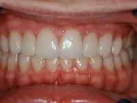 Konig Center for Cosmetic & Comprehensive Dentistry smile photos